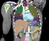 Real coronal CT with matching automatic segmentation masks